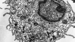 AML Cell TEM Image