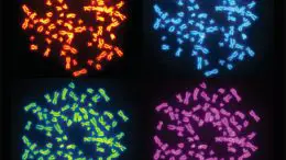Chromosomes in Cells With Whole Genome Doubling